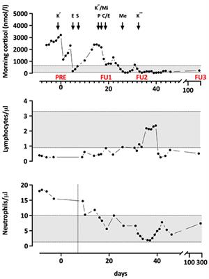 Case Report—Secondary Antibody Deficiency Due to Endogenous Hypercortisolism